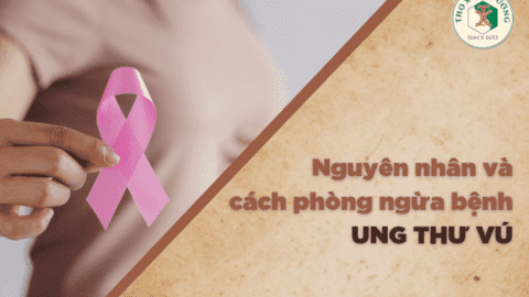 Nguyên nhân và cách phòng ngừa bệnh Ung thư vú