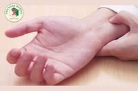 <a href="/kien-thuc-ngay-nay/cham-cuu-xbbh" title="Châm cứu - XBBH" rel="dofollow">Châm cứu - XBBH</a>