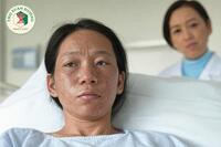 <a href="/benh-kho/xo-cung-bi" title="Xơ cứng bì" rel="dofollow">Xơ cứng bì</a>