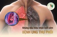 <a href="/benh-kho/ung-thu/u-phoi" title="U phổi" rel="dofollow">U phổi</a>