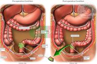<a href="/benh-pho-bien/benh-tieu-hoa/dai-truc-trang" title="Đại trực tràng" rel="dofollow">Đại trực tràng</a>