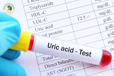 <a href="/benh-pho-bien/roi-loan-chuyen-hoa-lipid" title="Rối loạn chuyển hóa" rel="dofollow">Rối loạn chuyển hóa</a>