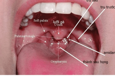 <a href="/benh-kho/ung-thu/u-thanh-quan" title="U khoang miệng, họng" rel="dofollow">U khoang miệng, họng</a>