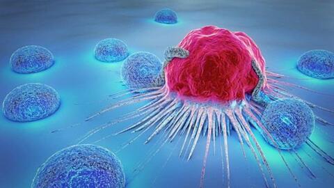 NCT - Chuyên gia luận về điều trị ung thư bằng y học cổ truyền