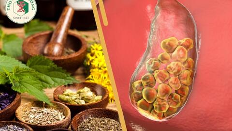 Trị sỏi mật hiệu quả bằng những bài thuốc dân gian
