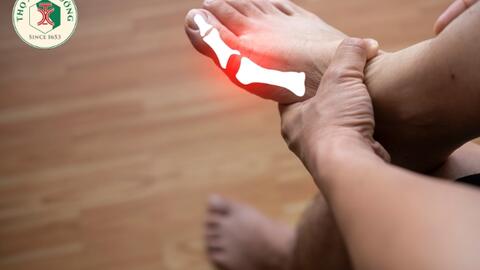 Tổng quan về bệnh Gout