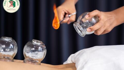 Khám phá cơ chế hoạt động nổi bật của giác hơi theo y khoa