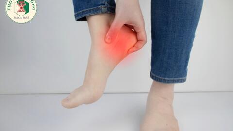 Gai gót chân và những điều cần biết