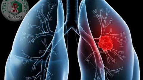 Bệnh phổi tắc nghẽn mãn tính là gì?