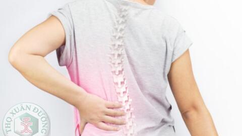 Nguyên nhân gây loãng xương và cách phòng ngừa hiệu quả