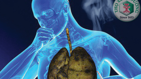 Tầm soát ung thư phổi như thế nào?