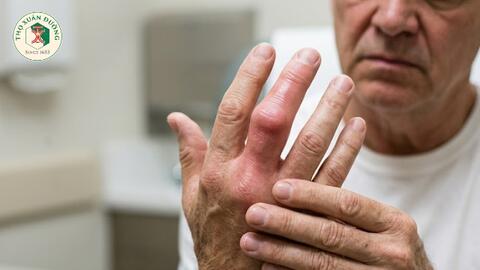 Cách nhận biết bệnh gout ở ngón tay