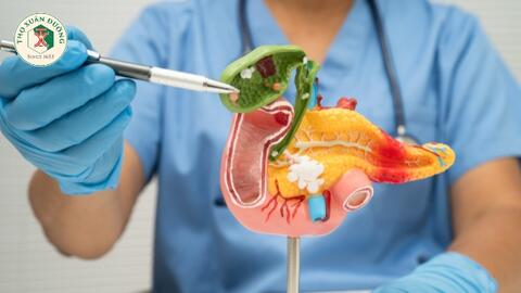 Nguyên nhân và triệu chứng của bệnh sỏi mật