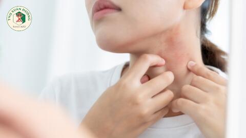 Tìm hiểu về nấm da