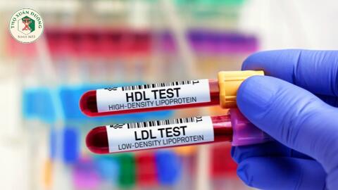 Làm thế nào để tăng Cholesterol HDL?