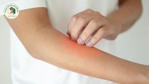 Viêm đa cơ và viêm da cơ tự miễn