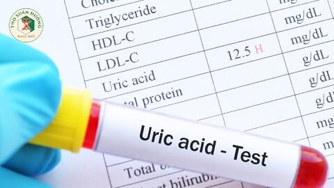 Những điều cần biết về tăng acid uric máu