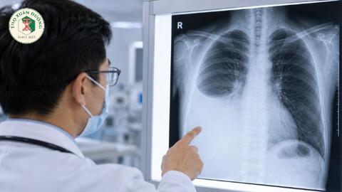 Nguyên nhân và xử trí tràn dịch màng phổi