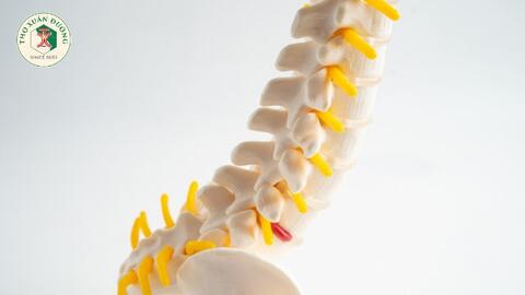 Thoát vị đĩa đệm ở người trẻ tuổi